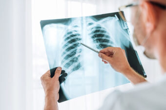 doctor reviewing an xray